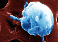 Теория рака и макробиотика